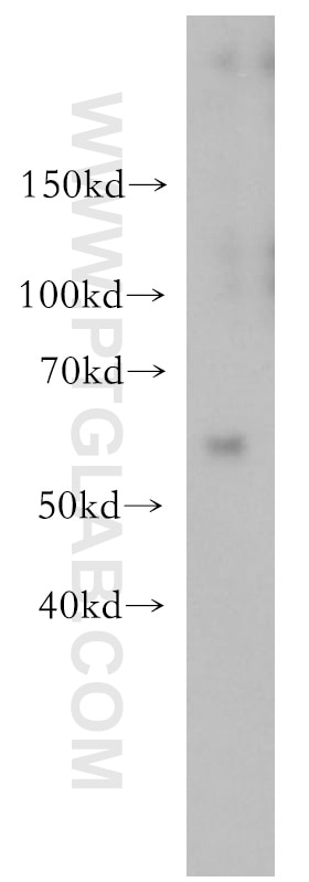 Western Blot (WB) analysis of human colon tissue using MEF2C Polyclonal antibody (18291-1-AP)