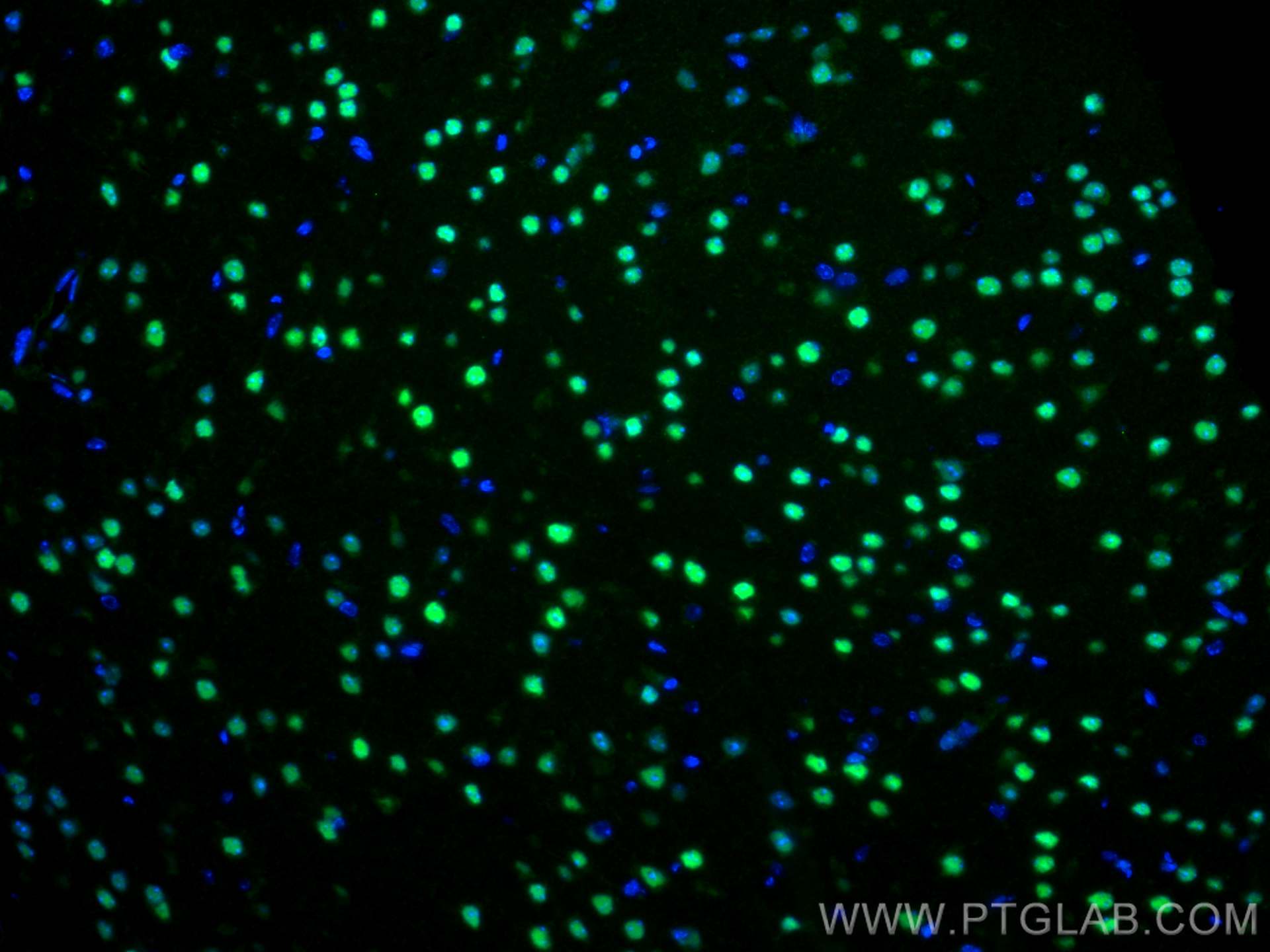 Immunofluorescence (IF) / fluorescent staining of mouse brain tissue using MEF2C Polyclonal antibody (20326-1-AP)