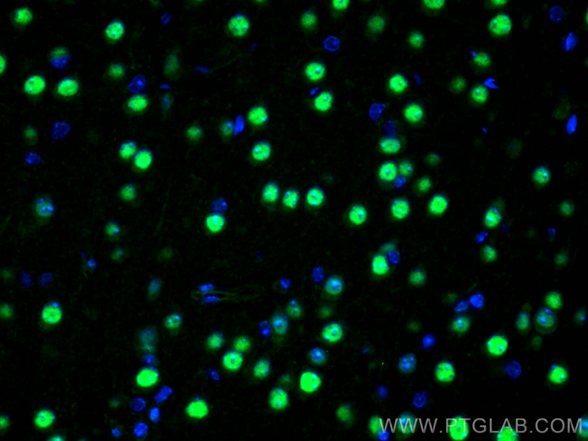 Immunofluorescence (IF) / fluorescent staining of mouse brain tissue using MEF2C Polyclonal antibody (20326-1-AP)