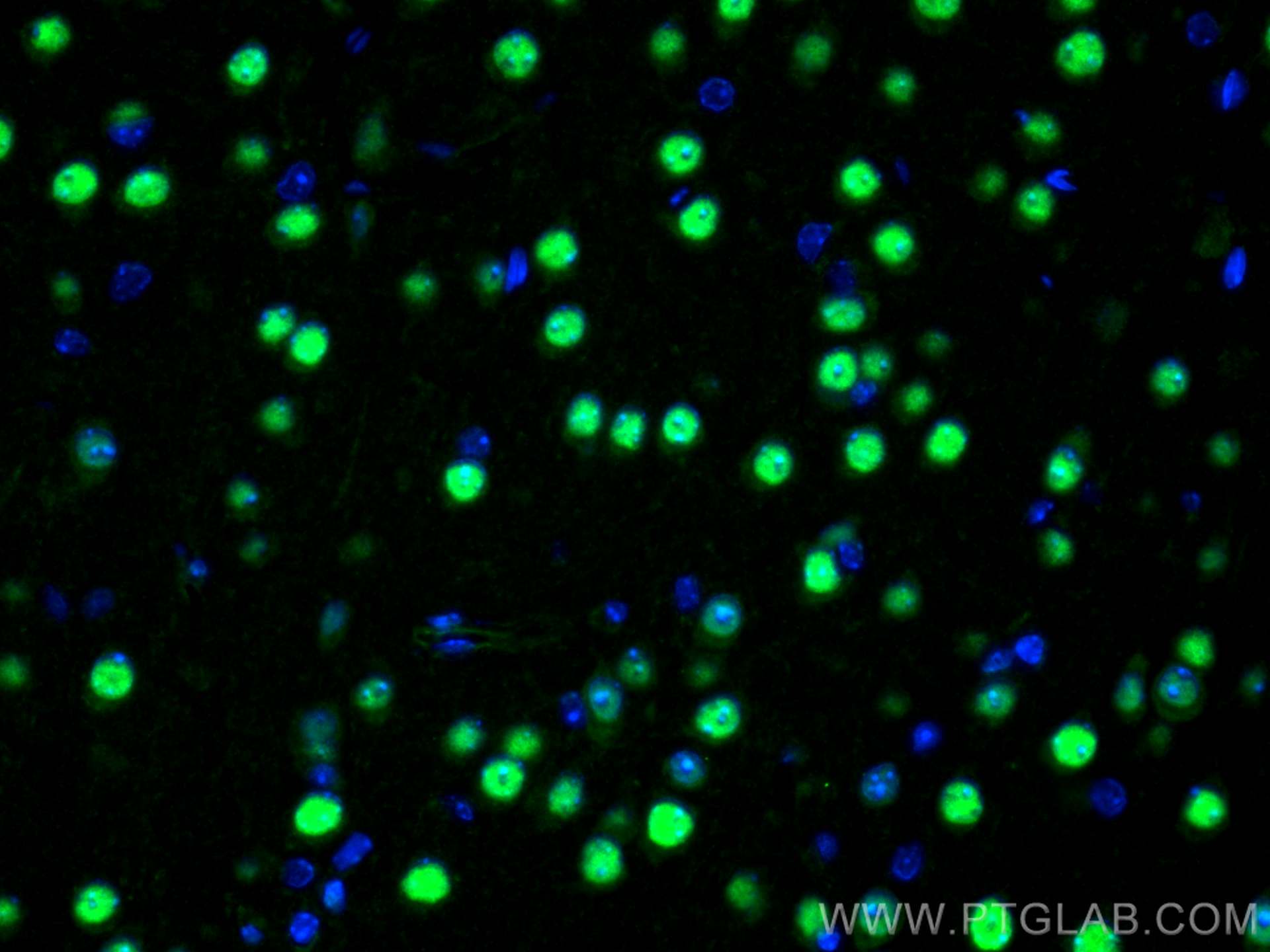 IF Staining of mouse brain using 20326-1-AP