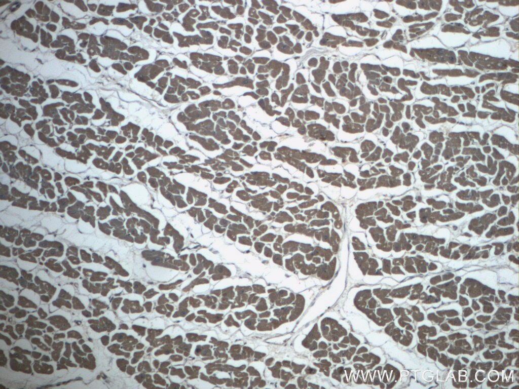 Immunohistochemistry (IHC) staining of human heart tissue using MEF2C Polyclonal antibody (20326-1-AP)