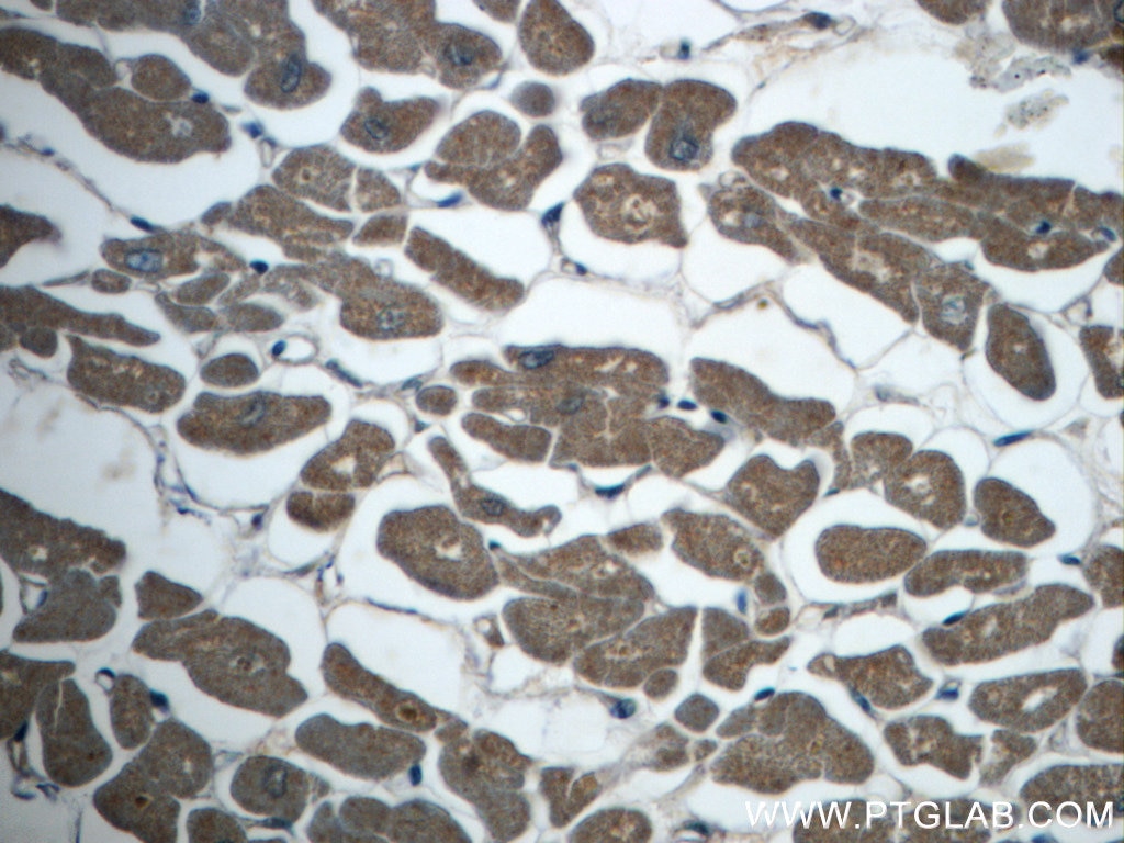 Immunohistochemistry (IHC) staining of human heart tissue using MEF2C Polyclonal antibody (20326-1-AP)