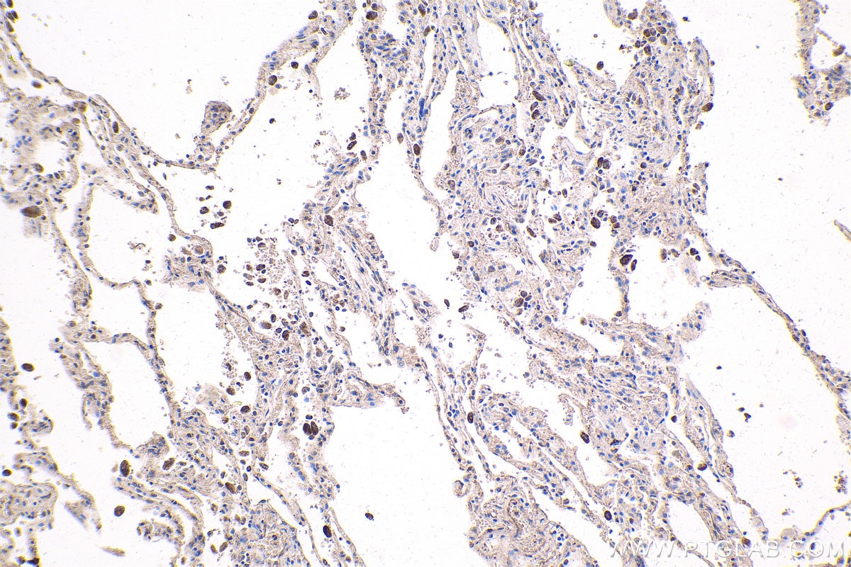 Immunohistochemistry (IHC) staining of human lung tissue using MEF2C Polyclonal antibody (20326-1-AP)