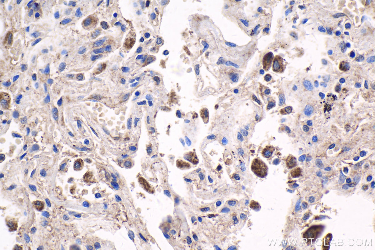 Immunohistochemistry (IHC) staining of human lung tissue using MEF2C Polyclonal antibody (20326-1-AP)