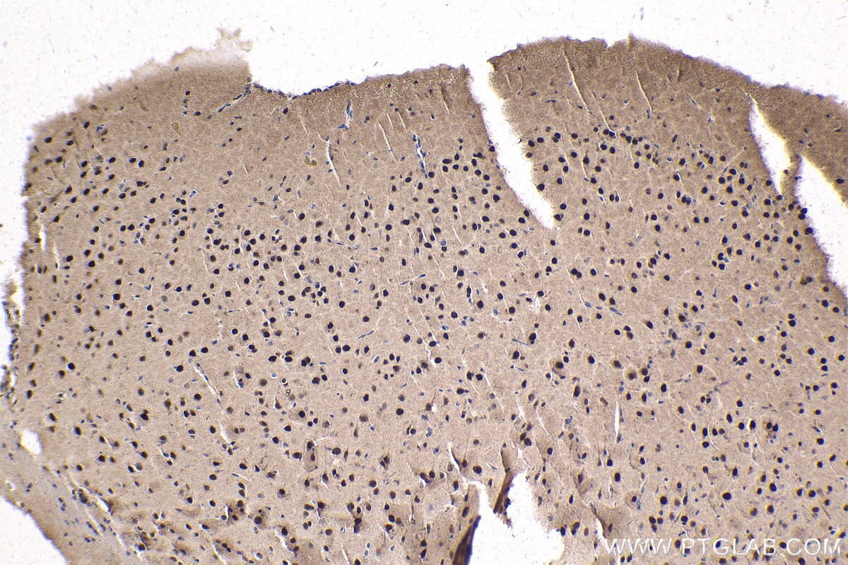 Immunohistochemistry (IHC) staining of rat brain tissue using MEF2C Polyclonal antibody (20326-1-AP)