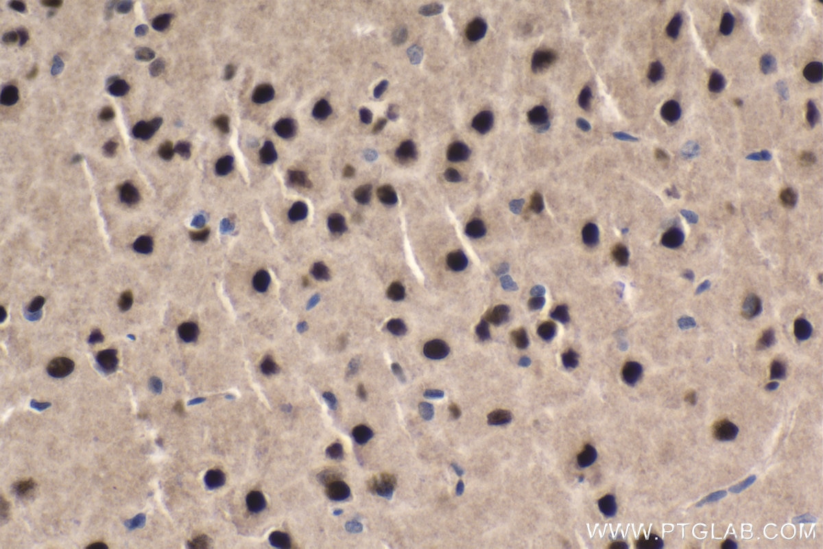 Immunohistochemistry (IHC) staining of rat brain tissue using MEF2C Polyclonal antibody (20326-1-AP)