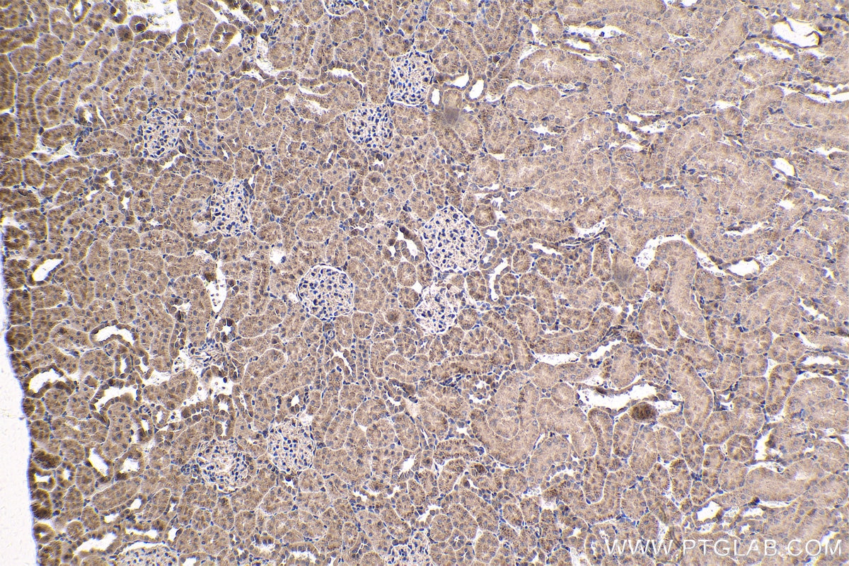 Immunohistochemistry (IHC) staining of rat kidney tissue using MEF2C Polyclonal antibody (20326-1-AP)