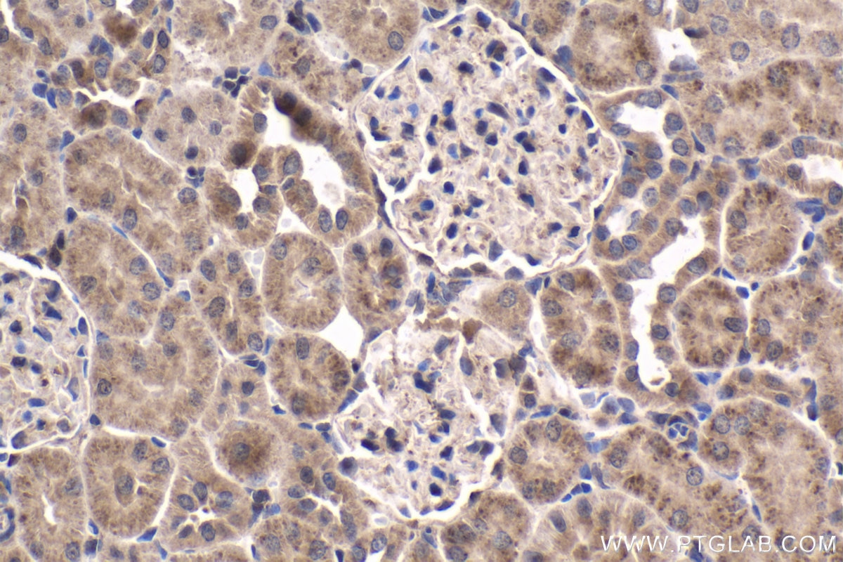 Immunohistochemistry (IHC) staining of rat kidney tissue using MEF2C Polyclonal antibody (20326-1-AP)