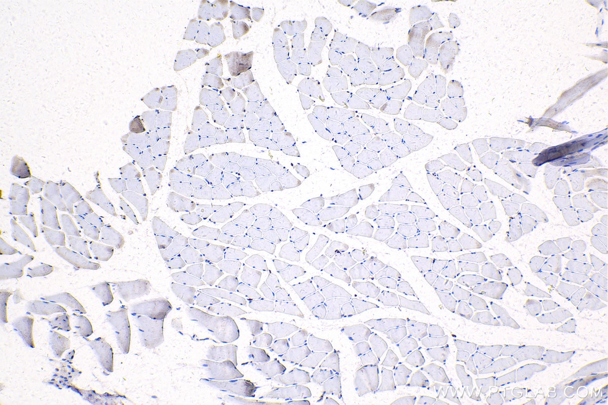 Immunohistochemistry (IHC) staining of rat skeletal muscle tissue using MEF2C Polyclonal antibody (20326-1-AP)