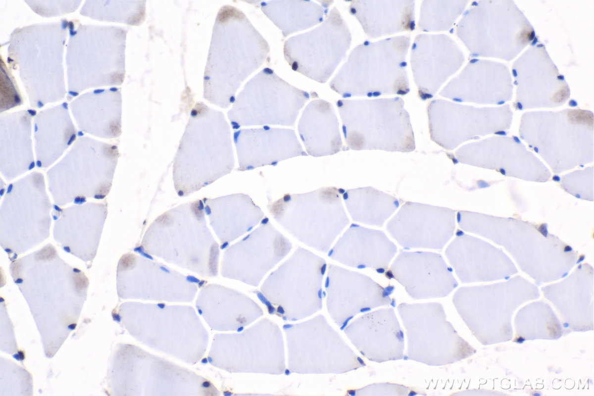 Immunohistochemistry (IHC) staining of rat skeletal muscle tissue using MEF2C Polyclonal antibody (20326-1-AP)