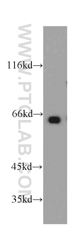 Western Blot (WB) analysis of HeLa cells using MEF2C Polyclonal antibody (20326-1-AP)
