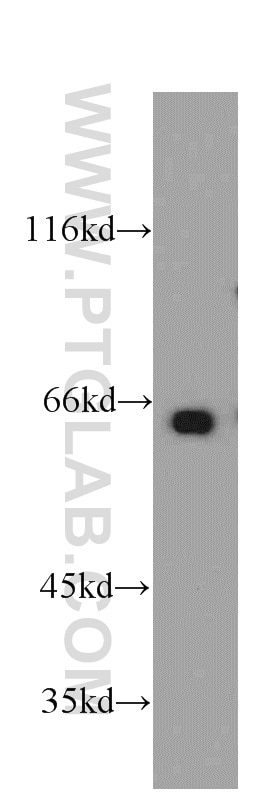 WB analysis of HeLa using 20326-1-AP