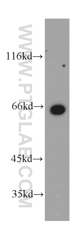Western Blot (WB) analysis of SH-SY5Y cells using MEF2C Polyclonal antibody (20326-1-AP)