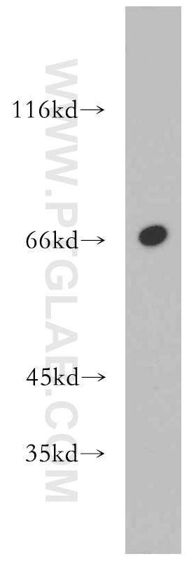 Western Blot (WB) analysis of mouse testis tissue using MEF2C Polyclonal antibody (20326-1-AP)