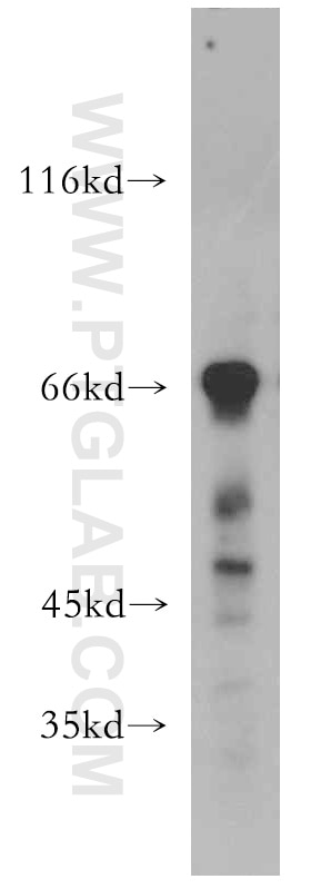 Western Blot (WB) analysis of mouse small intestine tissue using MEF2C Polyclonal antibody (20326-1-AP)