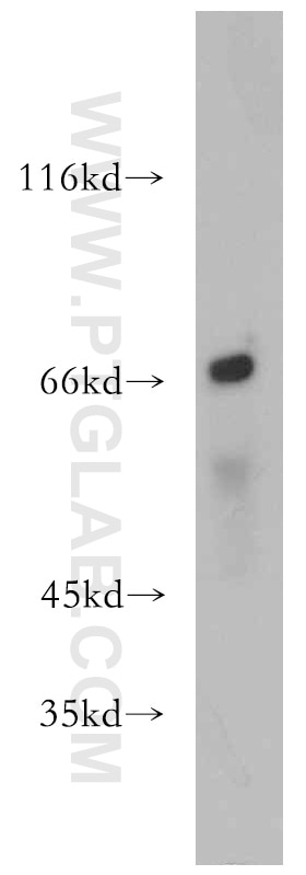 Western Blot (WB) analysis of rat lymph tissue using MEF2C Polyclonal antibody (20326-1-AP)