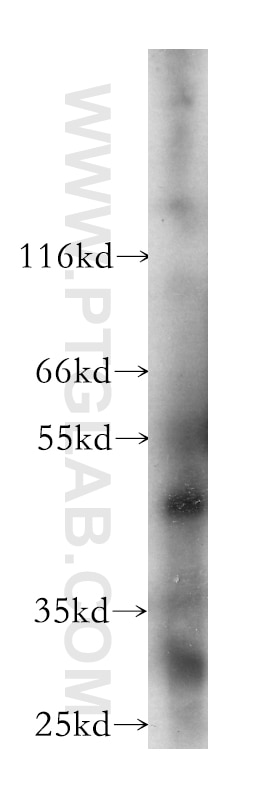 Western Blot (WB) analysis of SH-SY5Y cells using MEF2C Monoclonal antibody (60124-1-Ig)