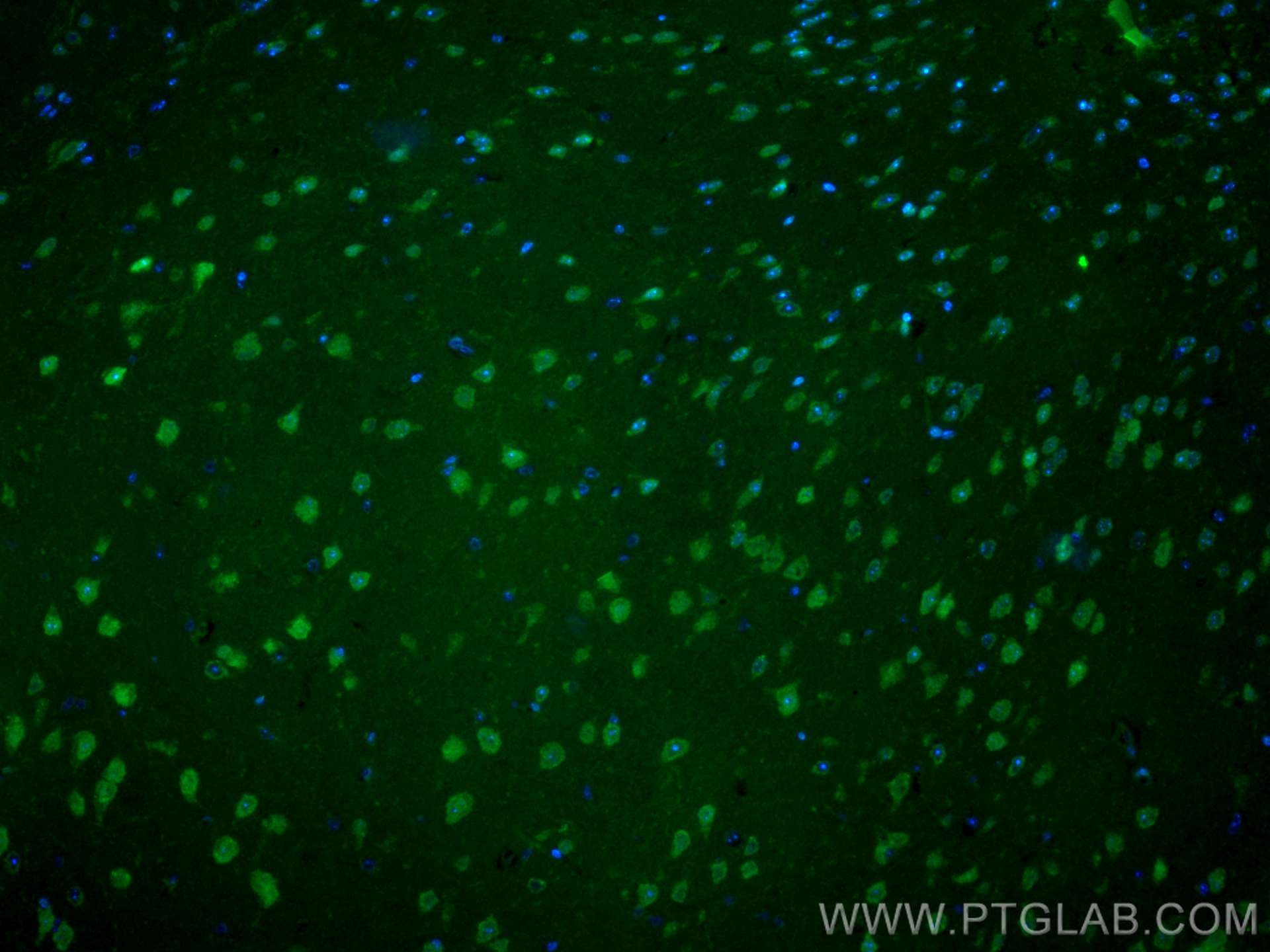Immunofluorescence (IF) / fluorescent staining of mouse brain tissue using CoraLite® Plus 488-conjugated MEF2C Polyclonal ant (CL488-20326)