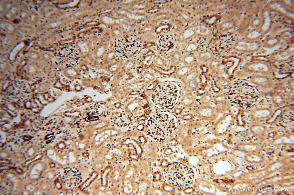 Immunohistochemistry (IHC) staining of human kidney tissue using MEF2C-Specific Polyclonal antibody (18293-1-AP)