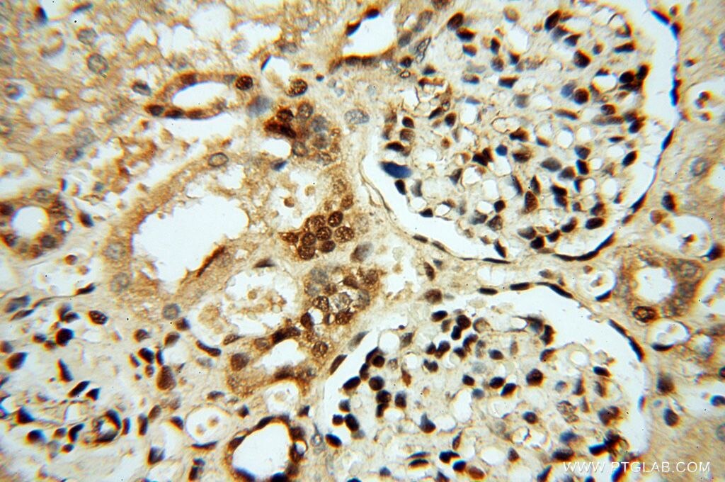 Immunohistochemistry (IHC) staining of human kidney tissue using MEF2C-Specific Polyclonal antibody (18293-1-AP)