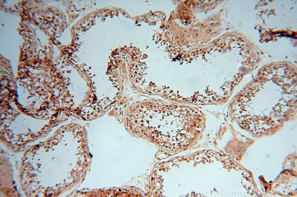 Immunohistochemistry (IHC) staining of human testis tissue using MEF2C-Specific Polyclonal antibody (18293-1-AP)