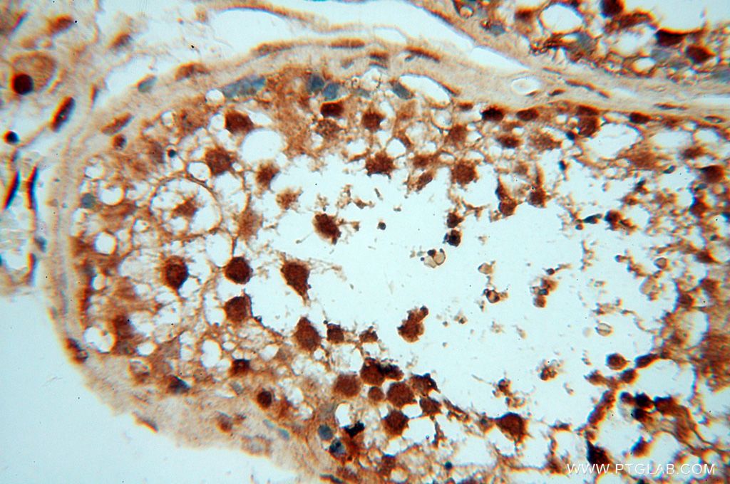 Immunohistochemistry (IHC) staining of human testis tissue using MEF2C-Specific Polyclonal antibody (18293-1-AP)