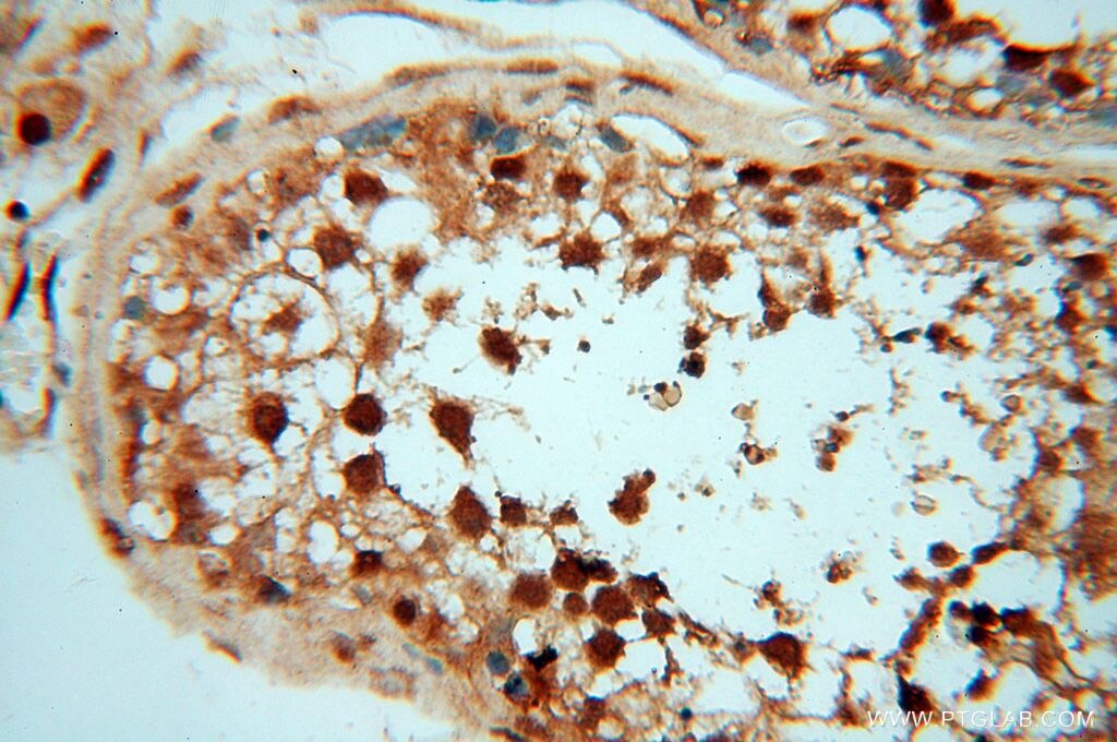 IHC staining of human testis using 18293-1-AP