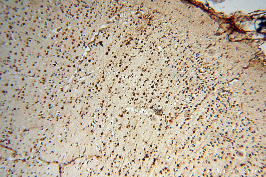Immunohistochemistry (IHC) staining of human brain tissue using MEF2C-Specific Polyclonal antibody (18293-1-AP)