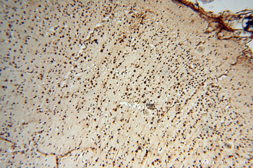 IHC staining of human brain using 18293-1-AP