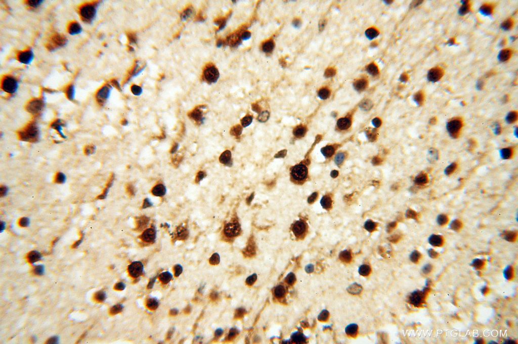 IHC staining of human brain using 18293-1-AP