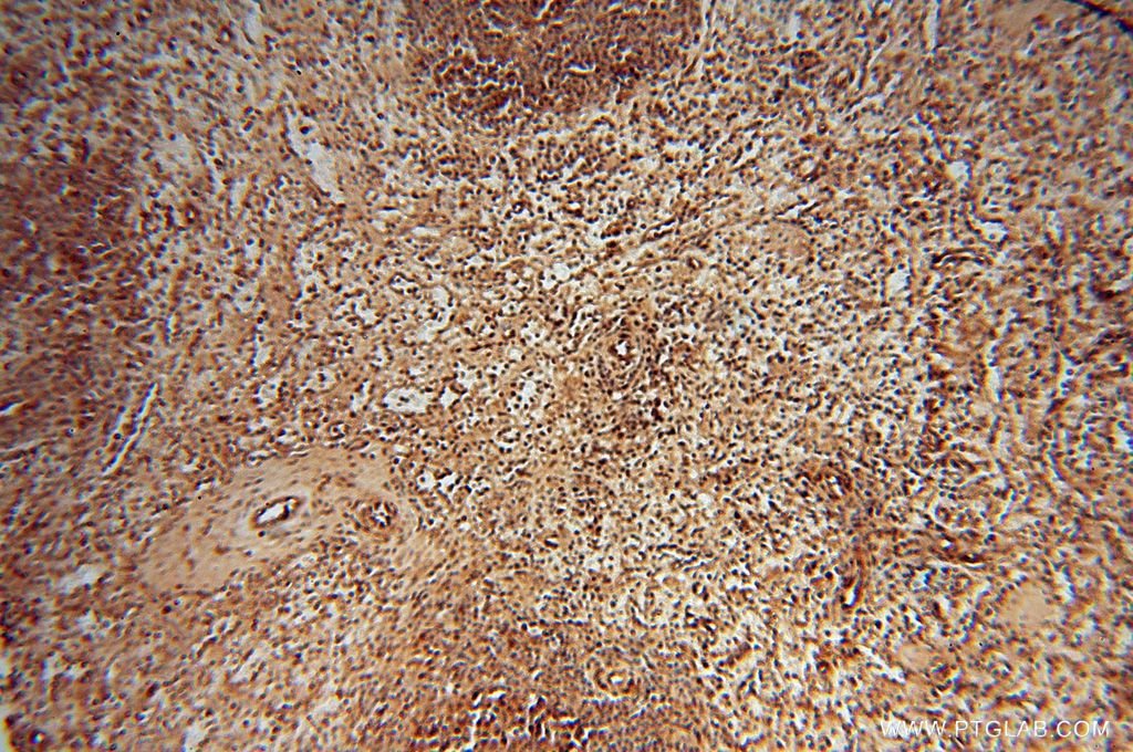 Immunohistochemistry (IHC) staining of human spleen tissue using MEF2C-Specific Polyclonal antibody (18293-1-AP)