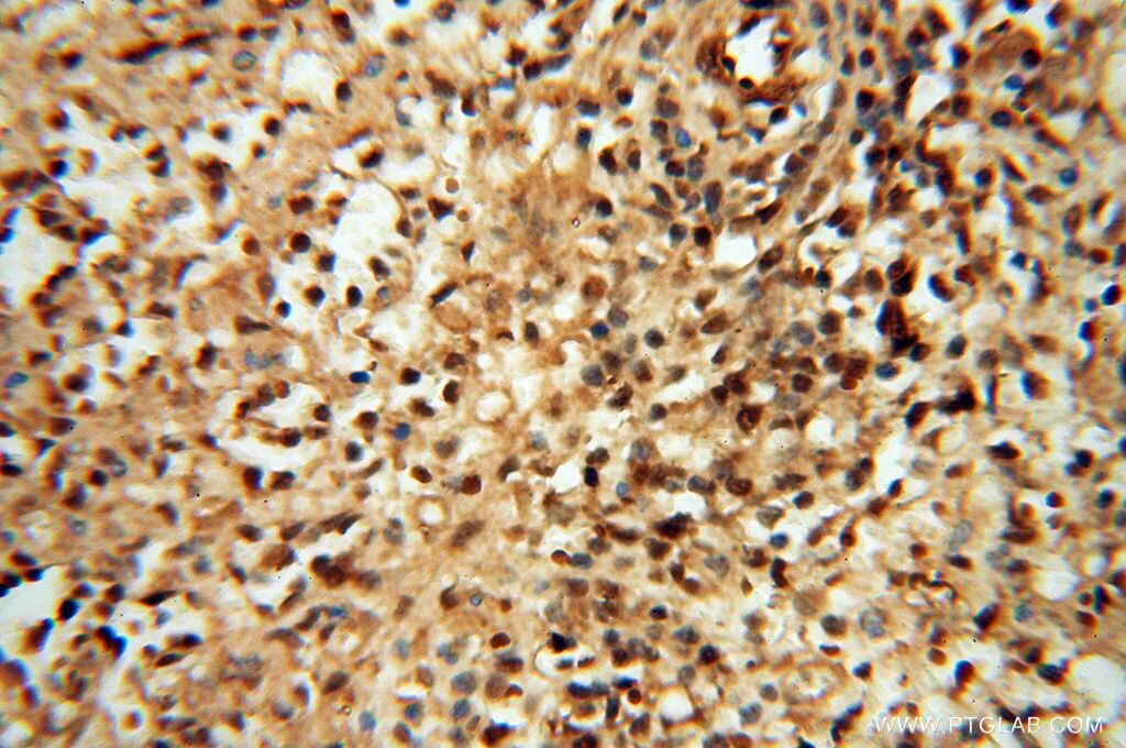 Immunohistochemistry (IHC) staining of human spleen tissue using MEF2C-Specific Polyclonal antibody (18293-1-AP)