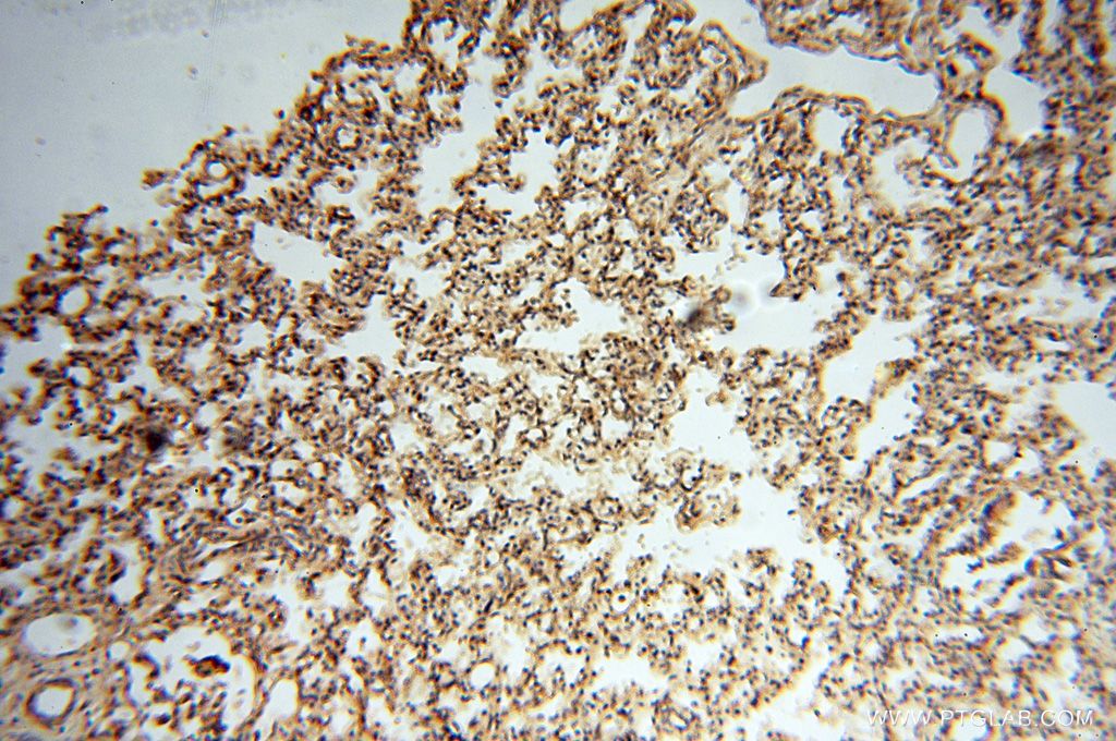 Immunohistochemistry (IHC) staining of human lung tissue using MEF2C-Specific Polyclonal antibody (18293-1-AP)
