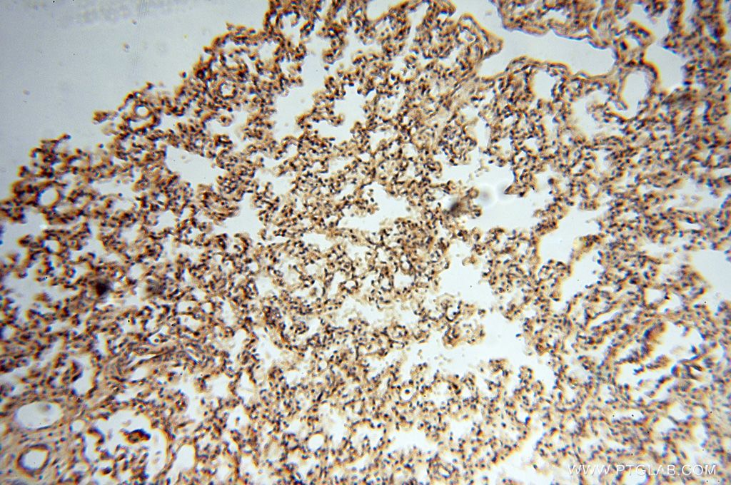 IHC staining of human lung using 18293-1-AP