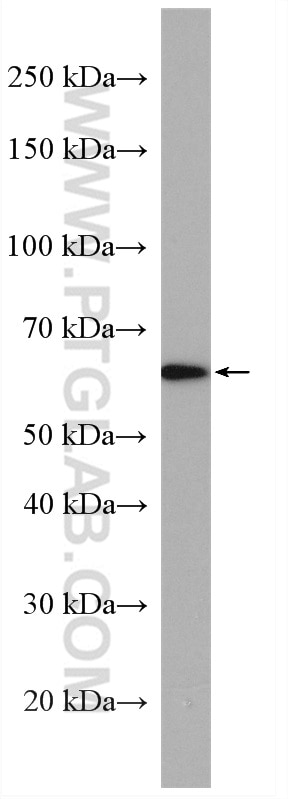 Western Blot (WB) analysis of SH-SY5Y cells using MEF2C-Specific Polyclonal antibody (18293-1-AP)