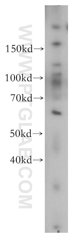 MEF2C-Specific