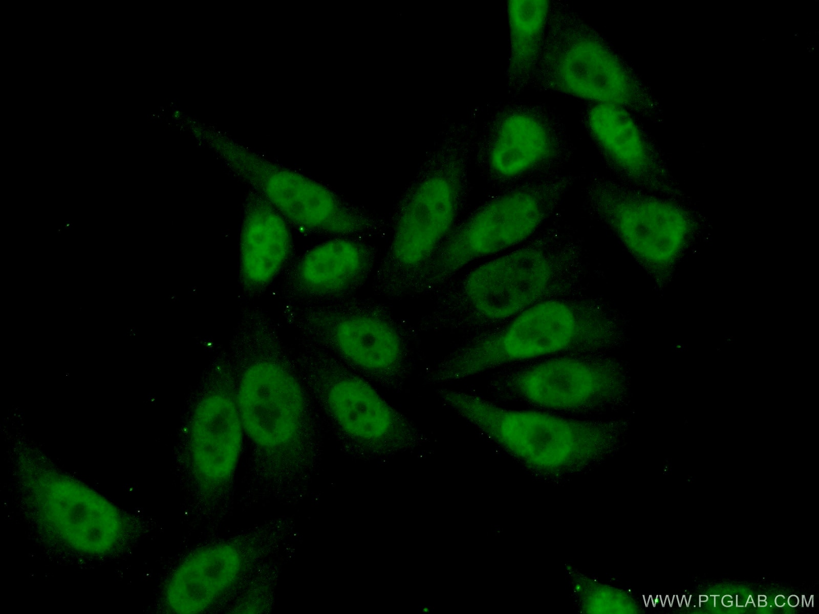 Immunofluorescence (IF) / fluorescent staining of HeLa cells using MEF2D Polyclonal antibody (14353-1-AP)