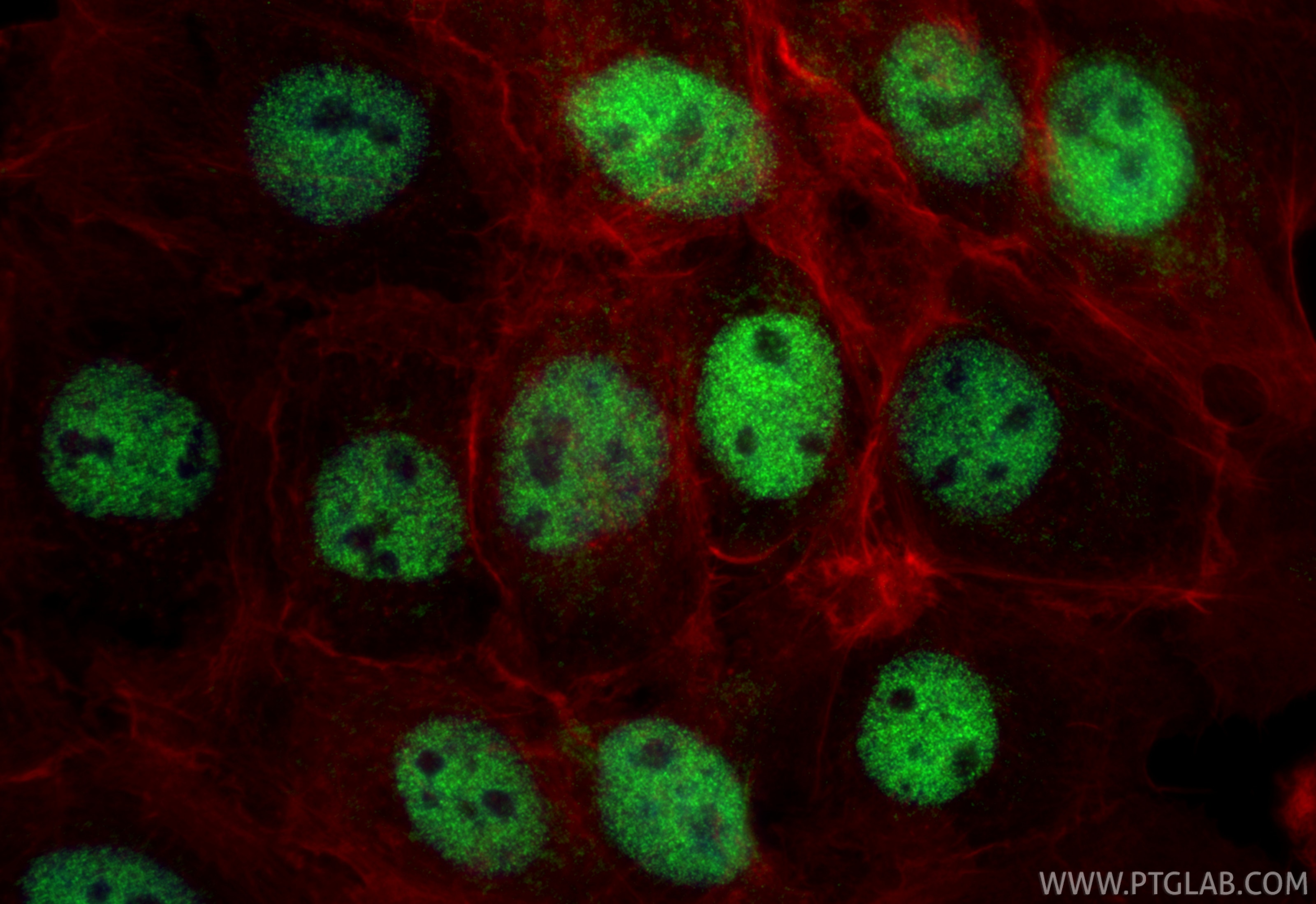 Immunofluorescence (IF) / fluorescent staining of A431 cells using MEF2D Polyclonal antibody (14353-1-AP)