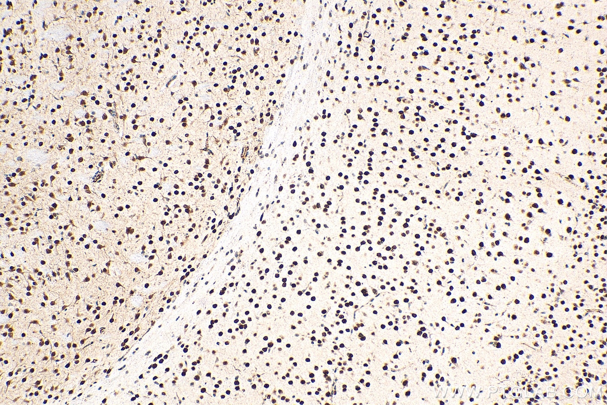 Immunohistochemistry (IHC) staining of mouse brain tissue using MEF2D Polyclonal antibody (14353-1-AP)