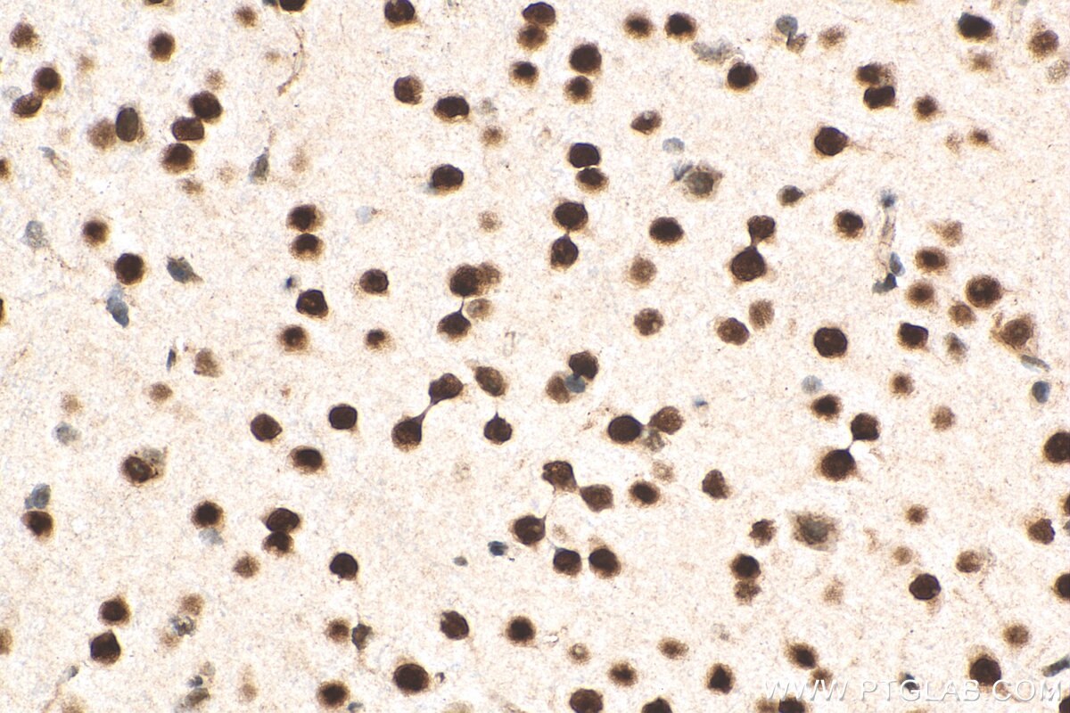 Immunohistochemistry (IHC) staining of mouse brain tissue using MEF2D Polyclonal antibody (14353-1-AP)