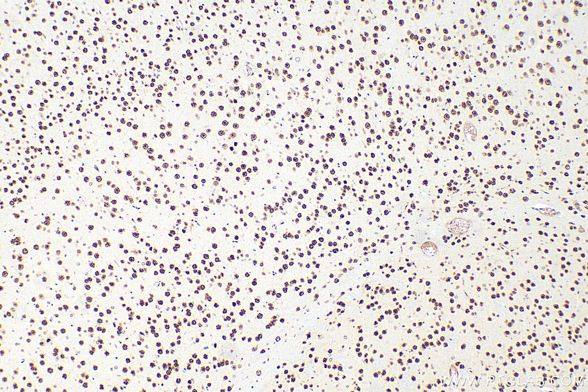 Immunohistochemistry (IHC) staining of mouse brain tissue using MEF2D Polyclonal antibody (14353-1-AP)