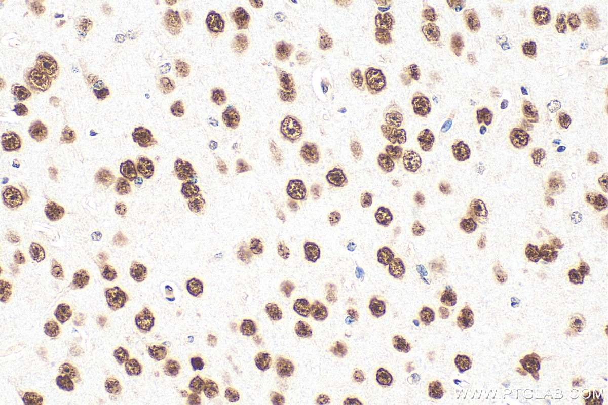 Immunohistochemistry (IHC) staining of mouse brain tissue using MEF2D Polyclonal antibody (14353-1-AP)