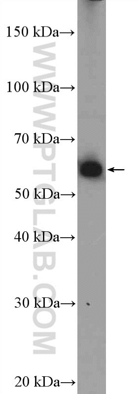 Western Blot (WB) analysis of HeLa cells using MEF2D Polyclonal antibody (14353-1-AP)