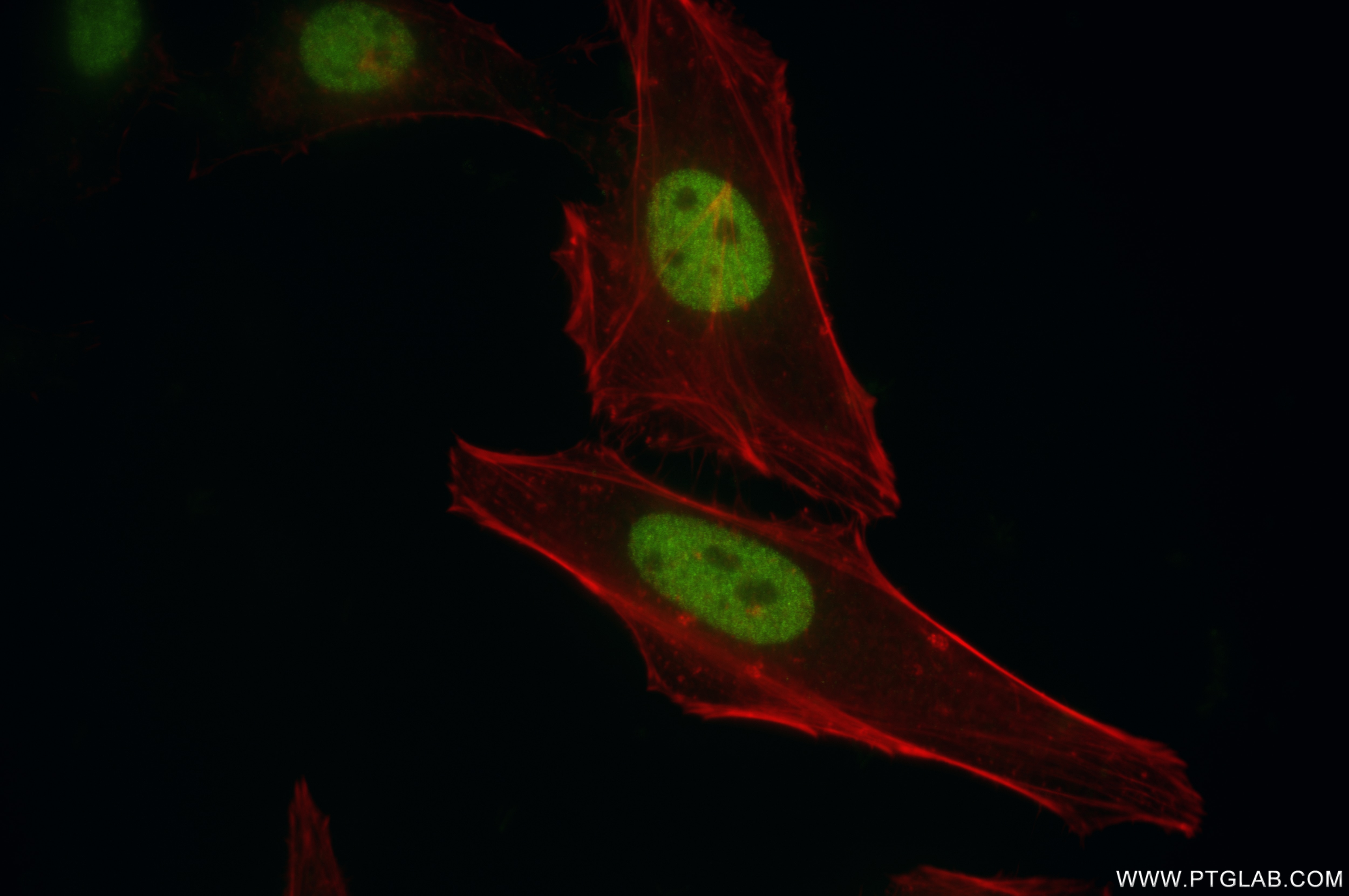 Immunofluorescence (IF) / fluorescent staining of HeLa cells using MEF2D Recombinant antibody (85801-5-RR)