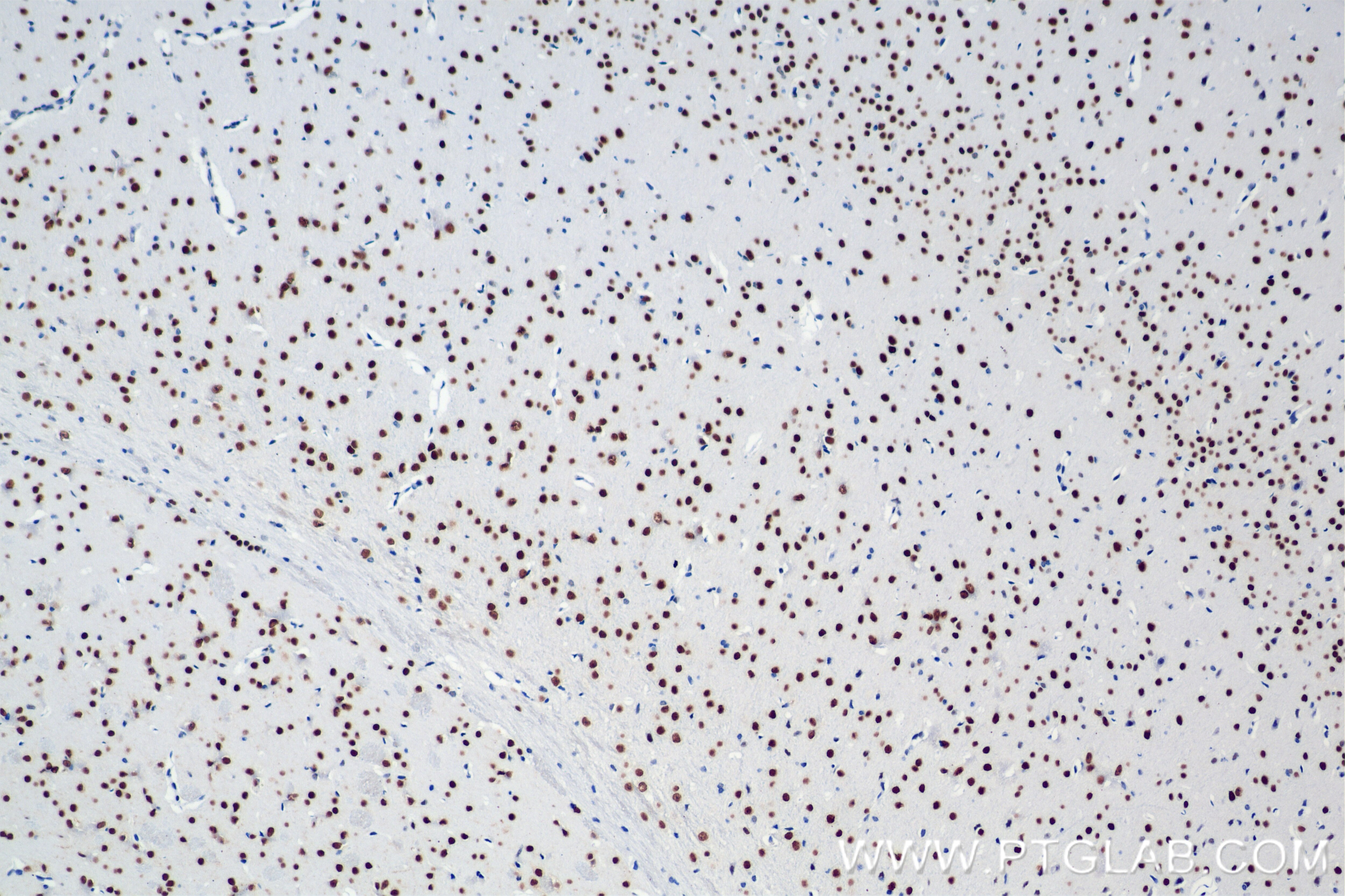 Immunohistochemistry (IHC) staining of mouse brain tissue using MEF2D Recombinant antibody (85801-5-RR)