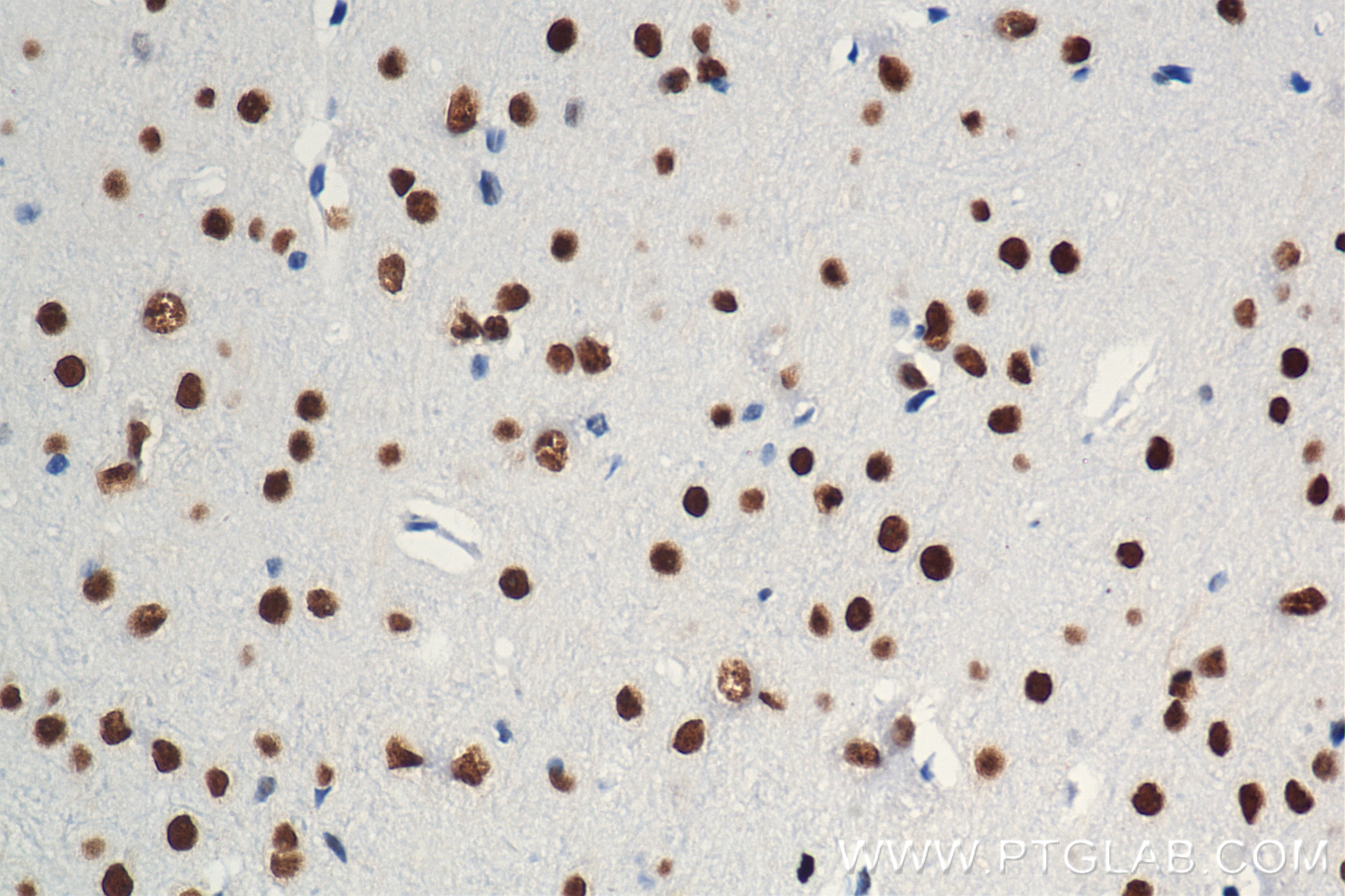 Immunohistochemistry (IHC) staining of mouse brain tissue using MEF2D Recombinant antibody (85801-5-RR)