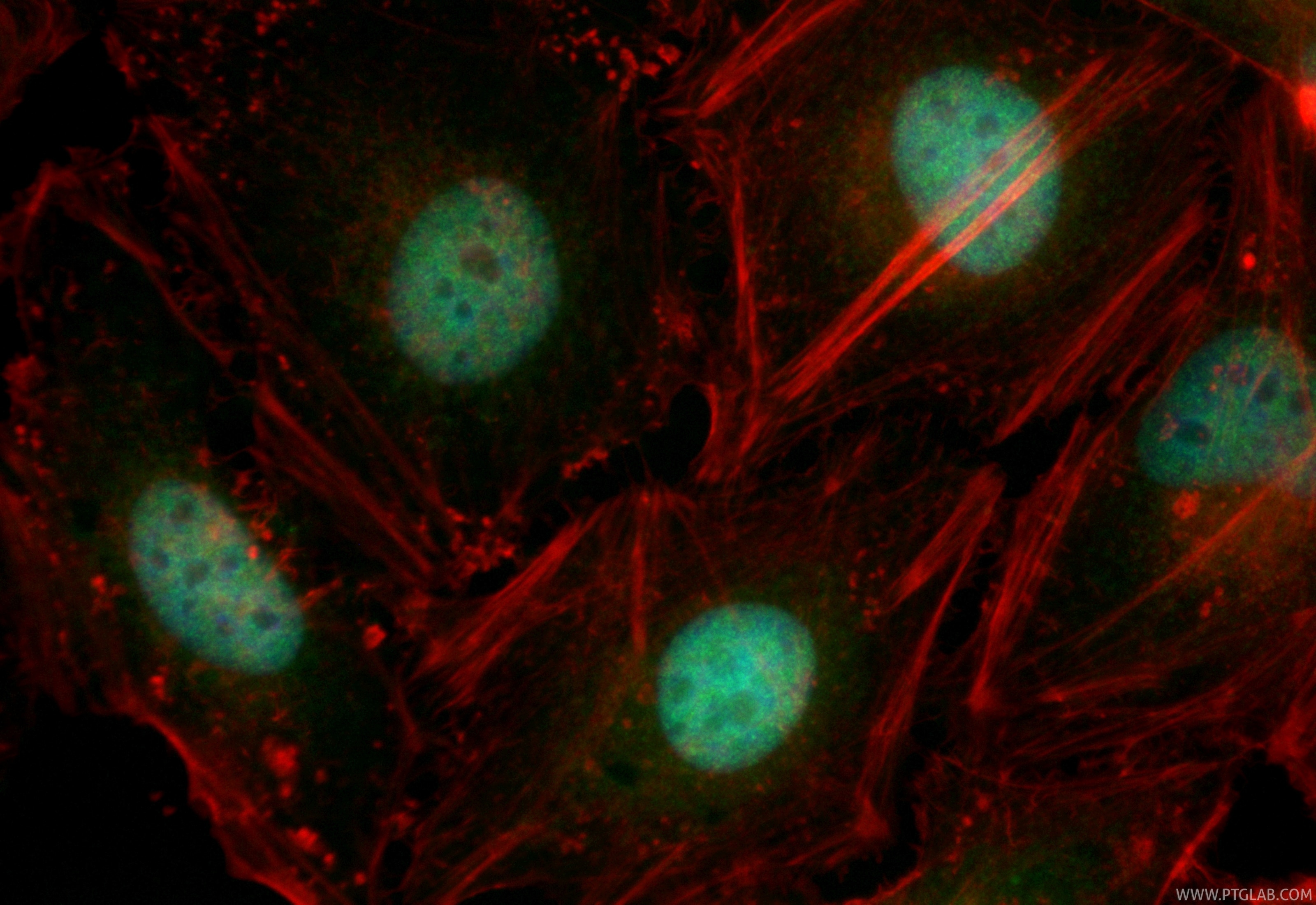 Immunofluorescent analysis of (4% PFA) fixed HeLa cells using CoraLite® Plus 488 MEF2D antibody (CL488-85801-5, Clone: 250068B7 ) at dilution of 1:200, CL594-phalloidin (red). Immunofluorescence (IF) / fluorescent staining of HeLa cells using CoraLite® Plus 488-conjugated MEF2D Recombinant mo (CL488-85801-5)