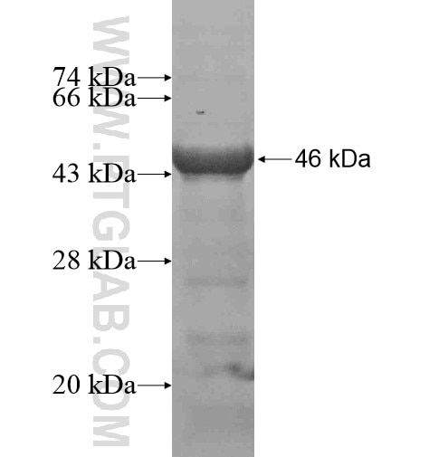 MEF2D fusion protein Ag14898 SDS-PAGE