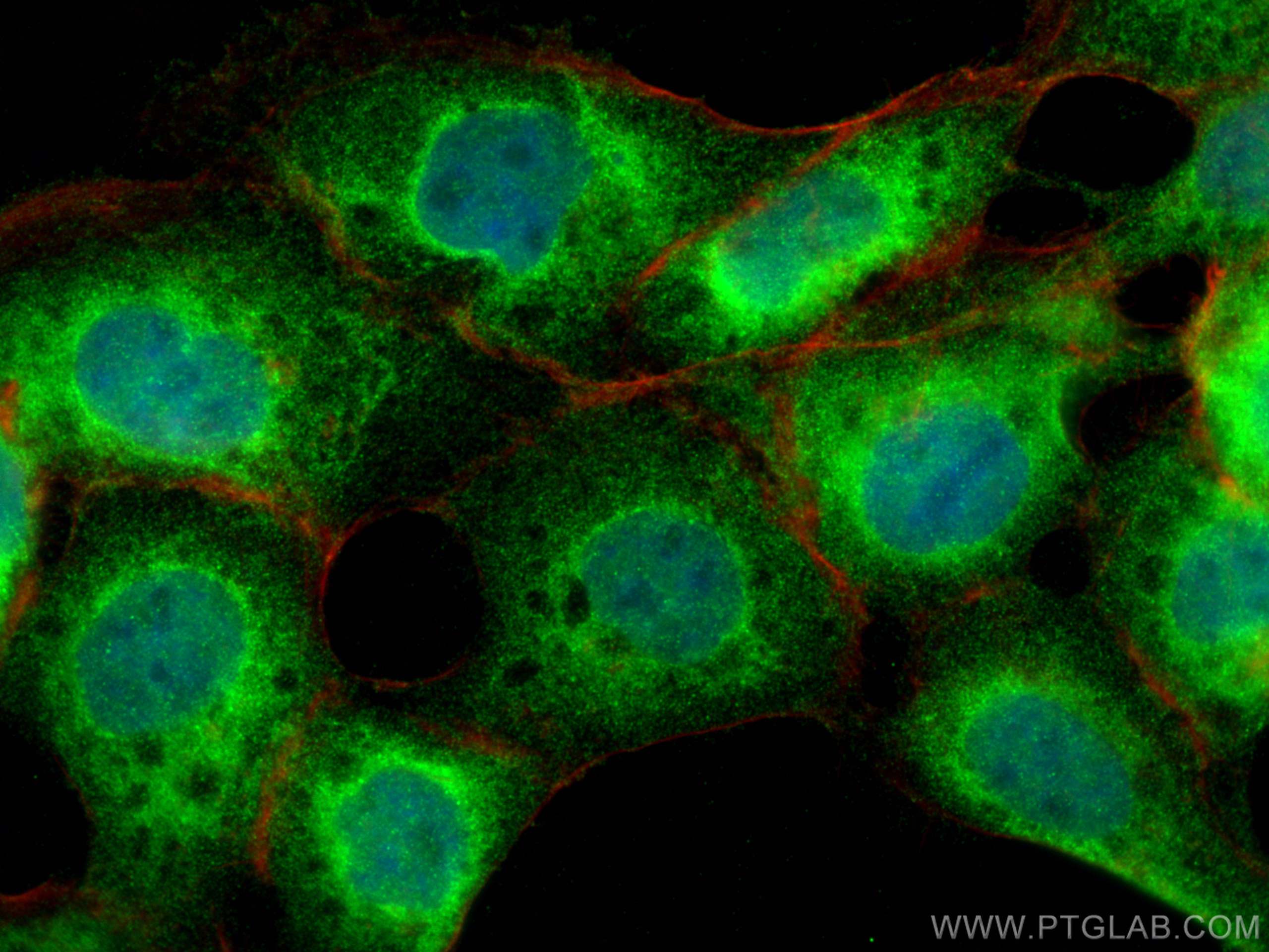 Immunofluorescence (IF) / fluorescent staining of A431 cells using MEFV Polyclonal antibody (24280-1-AP)