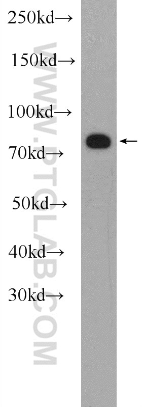 WB analysis of human plasma using 24280-1-AP